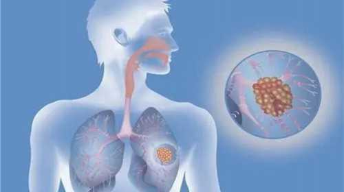 卵巢早衰可以试管吗？44岁卵巢早衰能做试管婴儿吗？~供卵正规机构